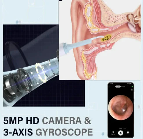 👂🔬 CLARIVIEW® OTOSCOPIO HD - 🏥✨ 50% OFF - STOCK FINAL ⏱